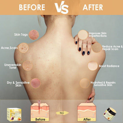 HoneyBee™ Bee Venom Skin Restoration Cream... The Tactical Revolution