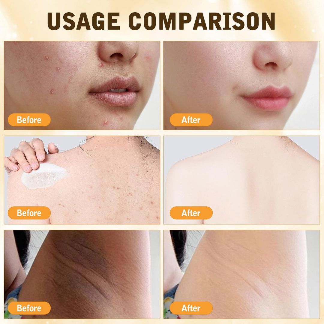 HoneyBee™ Bee Venom Skin Restoration Cream... The Tactical Revolution